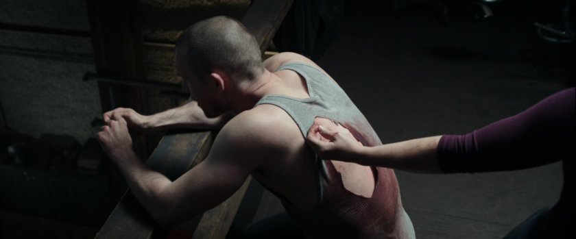 Ajax sitting on balcony having wound in his back sewn up.